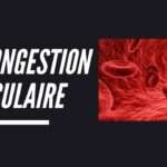Tout savoir sur la congestion du muscle et ses effets