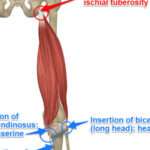 Insertion ischio jambier : comprendre l’anatomie et les implications